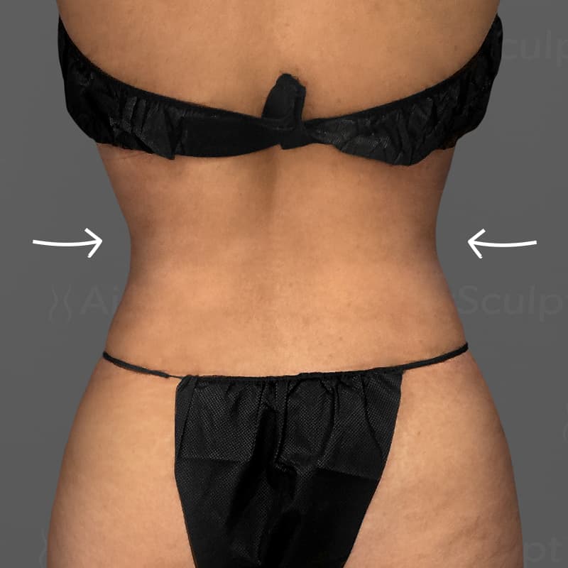 Back AirSculpt+ after