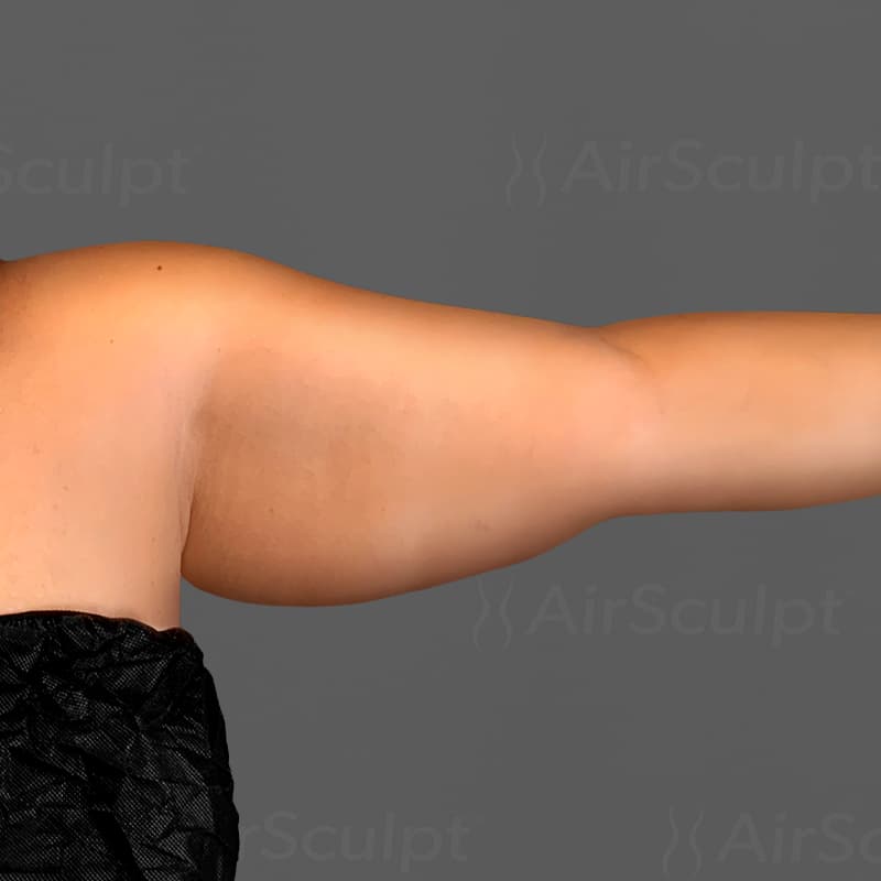 Arms before